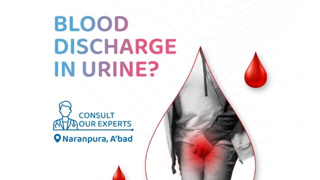 Best-Urology-Hospital-in-Ahmedabad