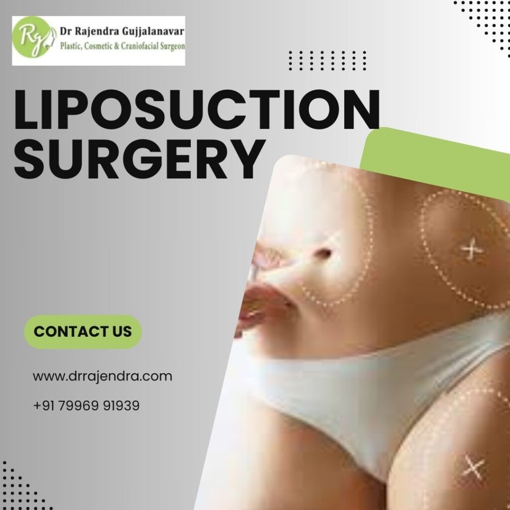 Liposuction Surgery in Bangalore | Safe & Effective Fat Removal