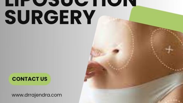 Liposuction-Surgery