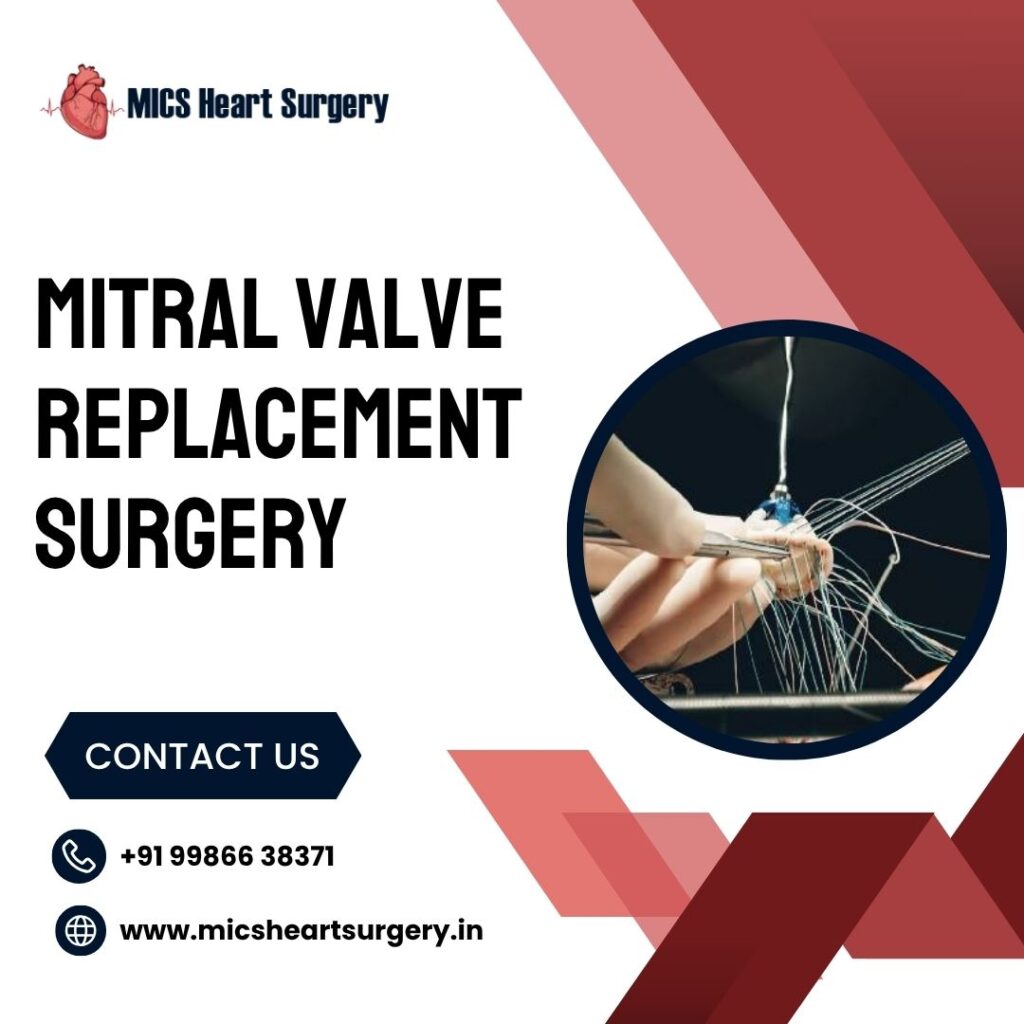 Mitral Valve Replacement Surgery Bangalore | MICS Cost