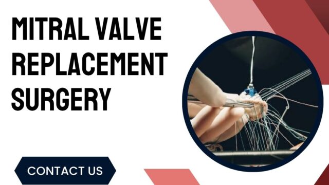 Mitral-Valve-Replacement-surgery