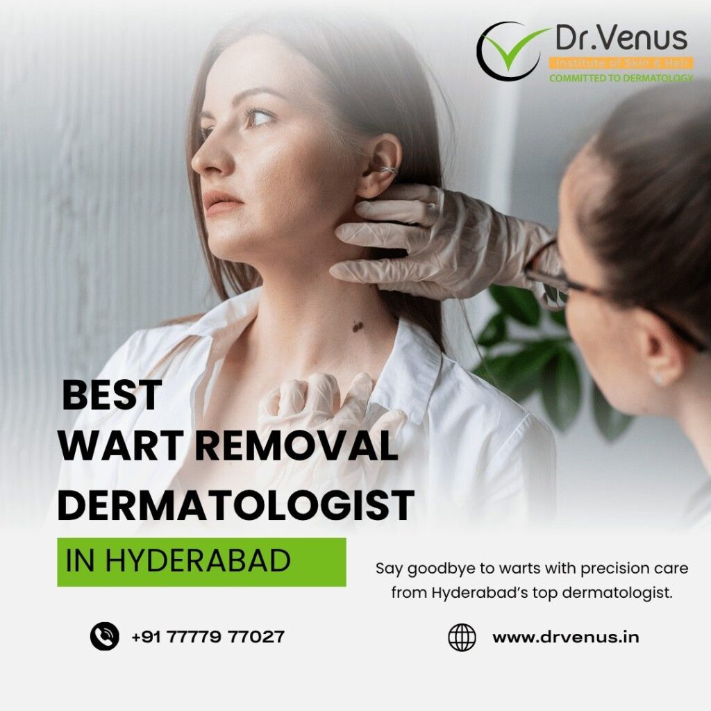 BestWartRemovalDermatologistInHyderabad